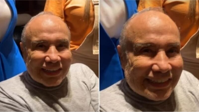 Stênio Garcia afirma que rosto está normal após harmonização facial