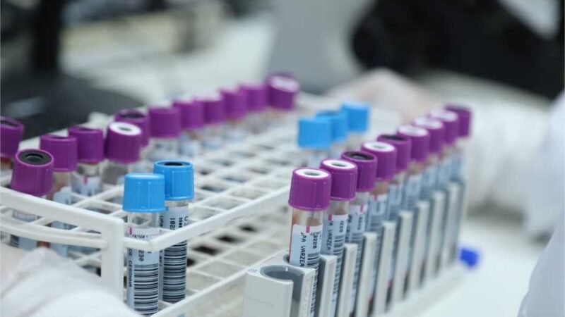 O Hospital Pronto Socorro Municipal de VG colocou em funcionamento novos serviços e exames para atendimento mais eficientes e de resultados para os pacientes que dependem do SUS.