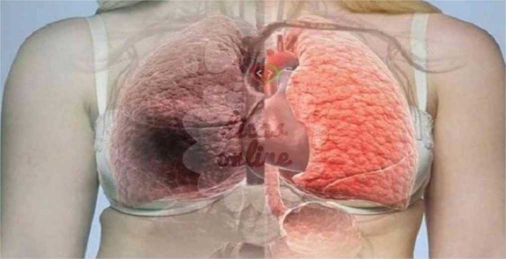 Receita caseira para limpar os pulmões e respirar melhor