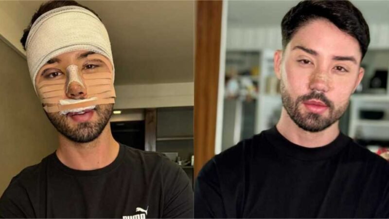 Após mudar aparência, Melquíades é internado com urgência