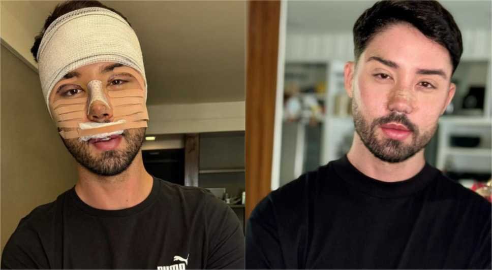 Após mudar aparência, Melquíades é internado com urgência