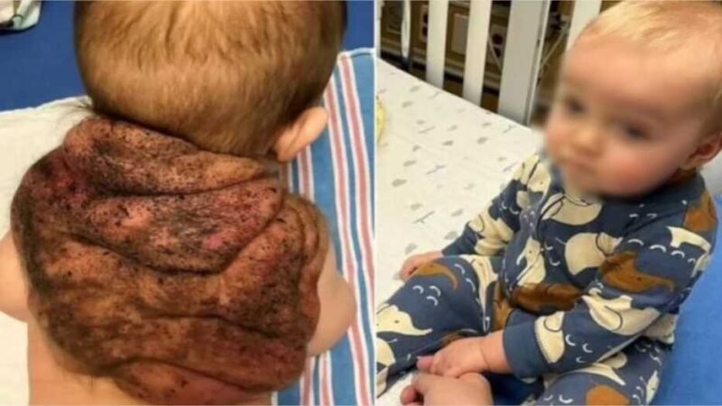 Este caso raro na medicina viralizou após ganhar as manchetes dos principais portais de notícias do mundo.