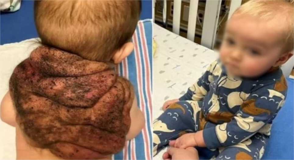 Este caso raro na medicina viralizou após ganhar as manchetes dos principais portais de notícias do mundo.