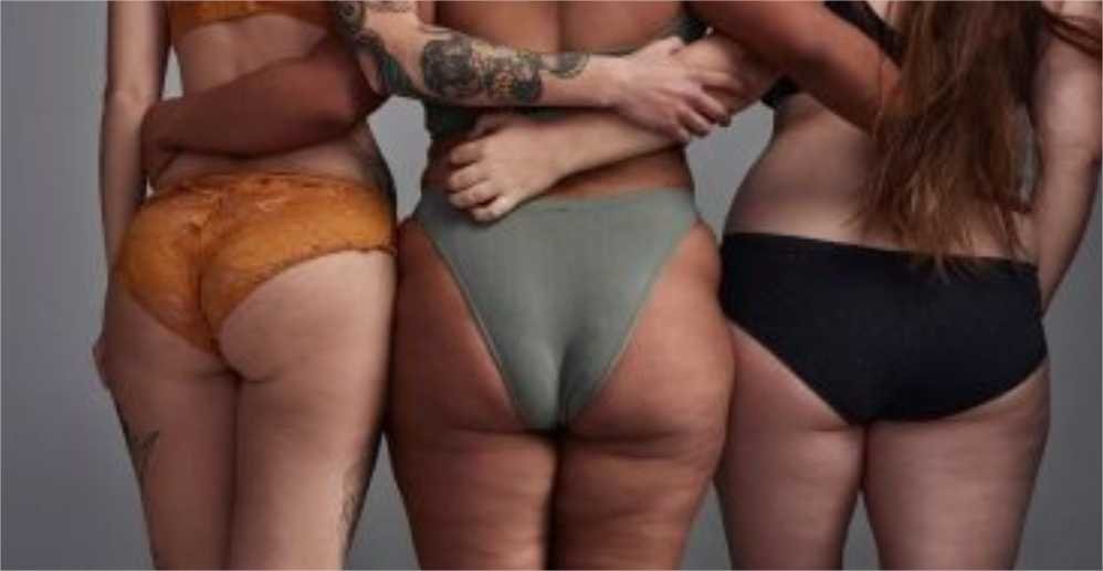 Especialista responde principais dúvidas sobre como acabar com a celulite