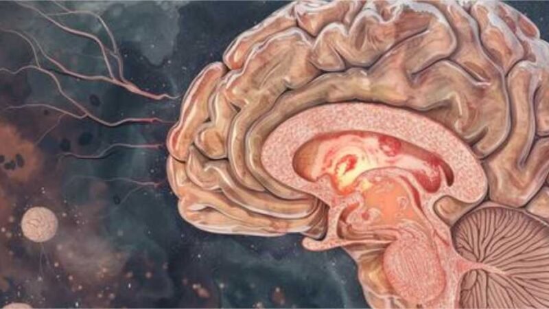 Assim fica o cérebro de uma pessoa que vê pornografia