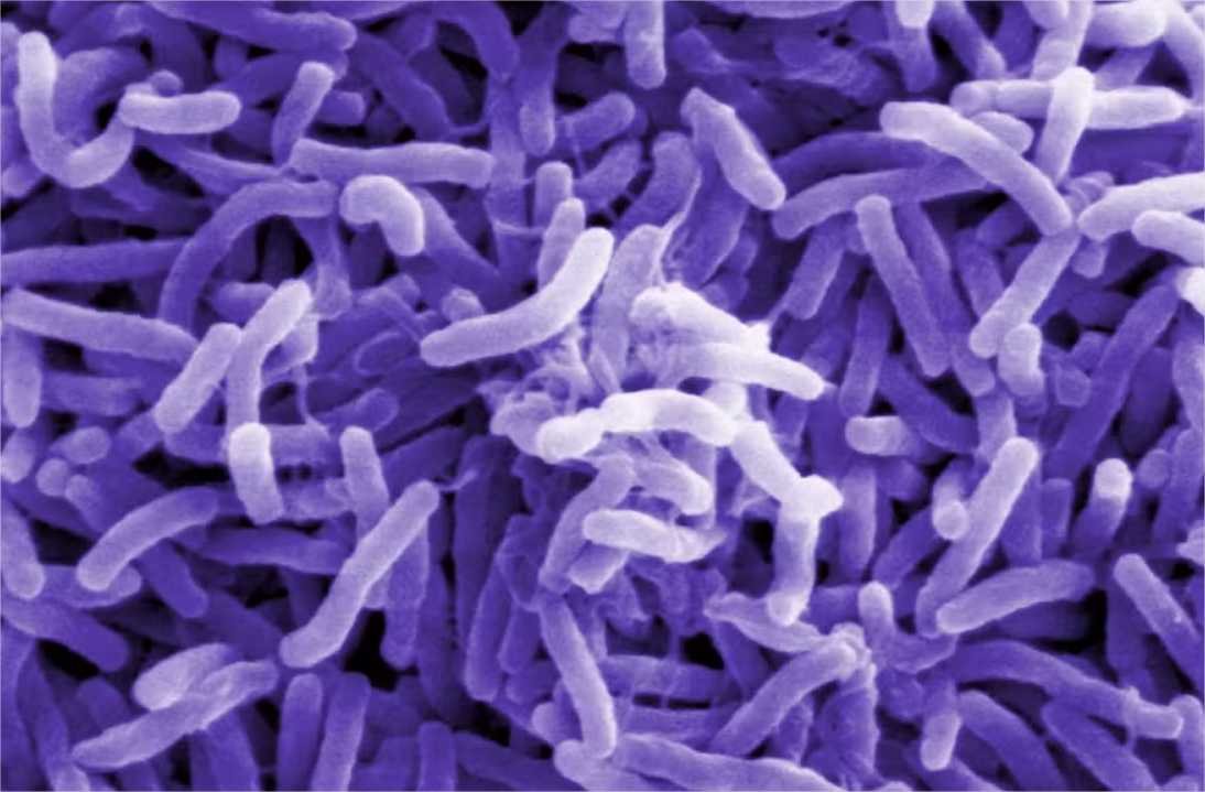 O que se sabe sobre o primeiro caso local de cólera no Brasil após 18 anos