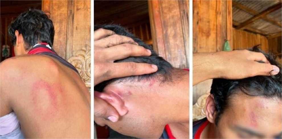 Mãe de menor agredido por PMs registra boletim de ocorrência e expõe hematomas; veja vídeo