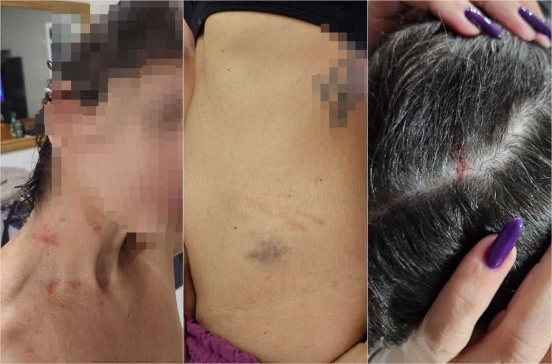 “Vivendo filme de terror”, diz servidora que denunciou agressão