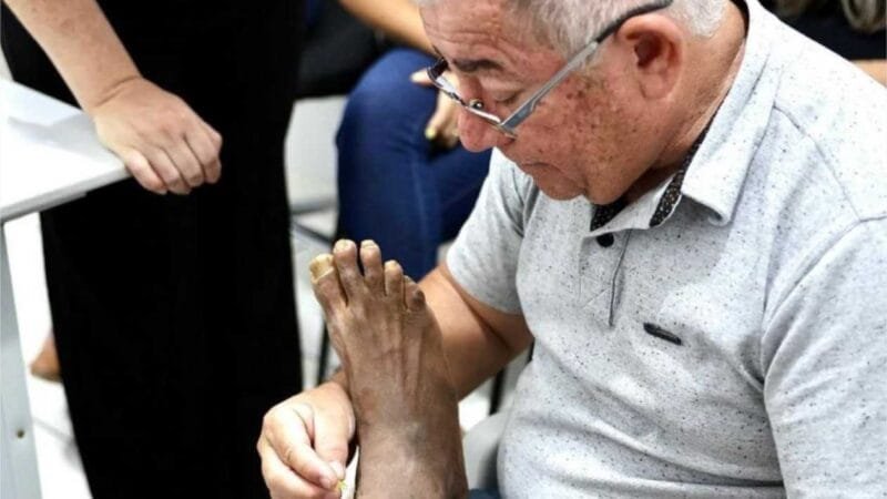 SES promove capacitação sobre hanseníase para profissionais de saúde