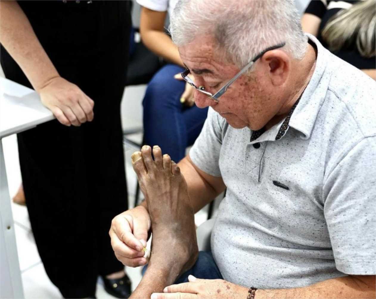 SES promove capacitação sobre hanseníase para profissionais de saúde