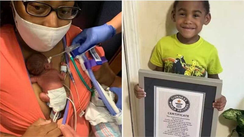 Bebê mais prematuro do mundo comemora aniversário de 4 anos