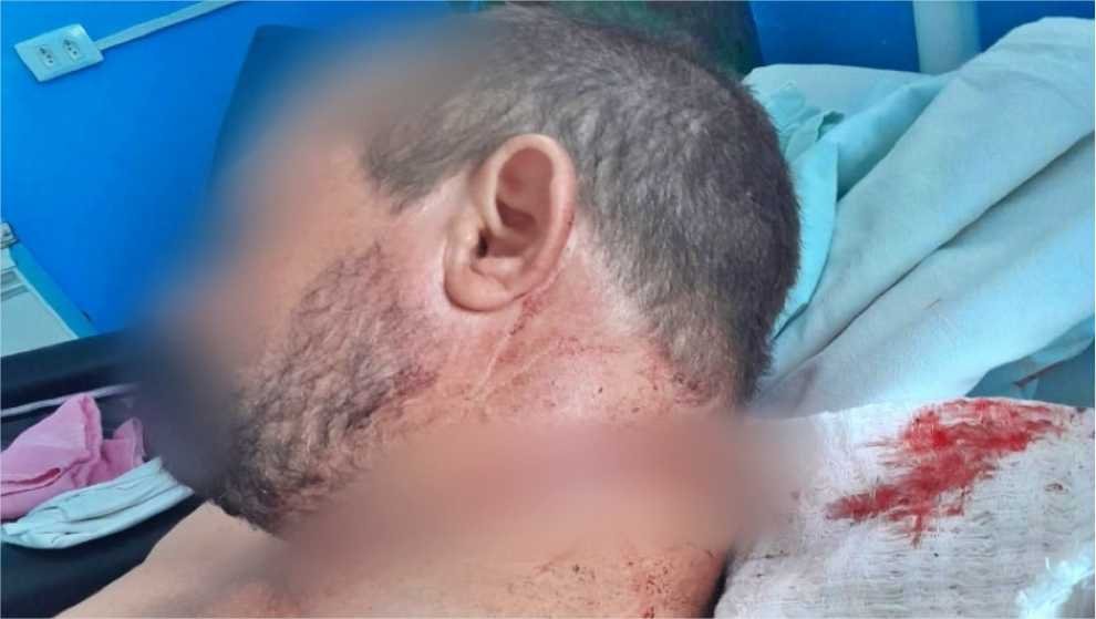 Confusão no “Bar do Kiko” termina com homem esfaqueado no pescoço