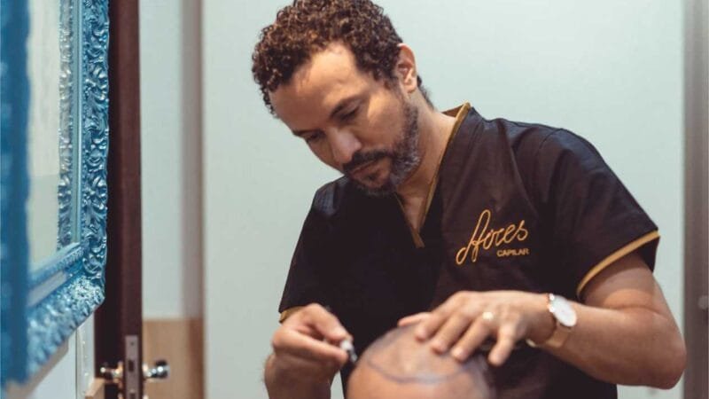 Cuiabá leva técnicas de transplante capilar para São Paulo