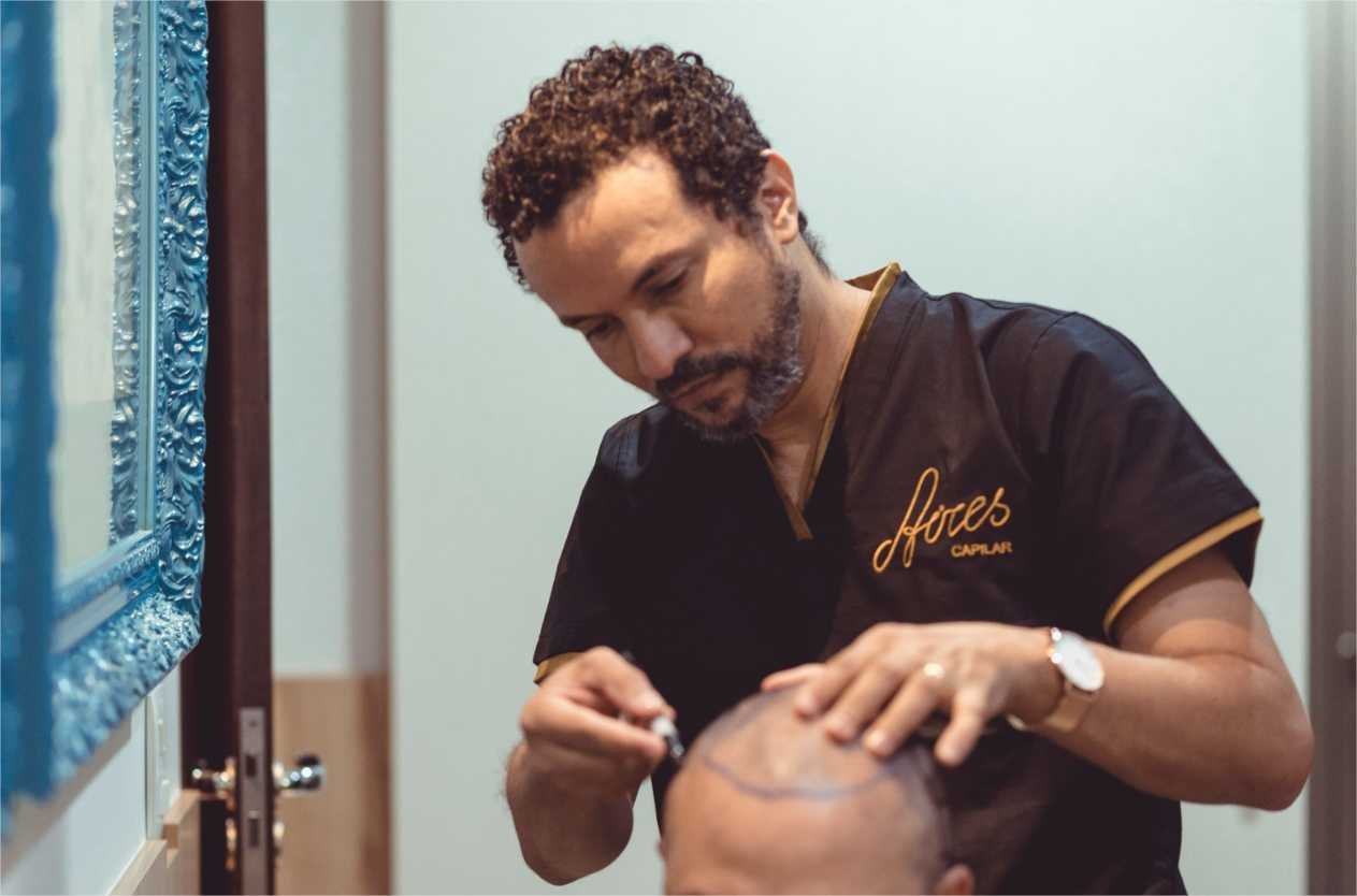 Cuiabá leva técnicas de transplante capilar para São Paulo