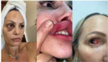 Investigador da Polícia Civil acusado de agredir personal trainer é preso em Cuiabá