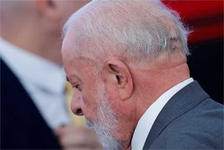 Um dia após cirurgia na cabeça, Lula está ‘lúcido, orientado e passou a noite bem’, diz boletim médico