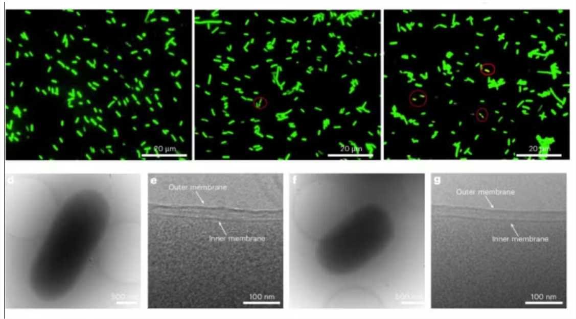 Cientistas revestem bactérias com “capa de Superman” para criarem remédios