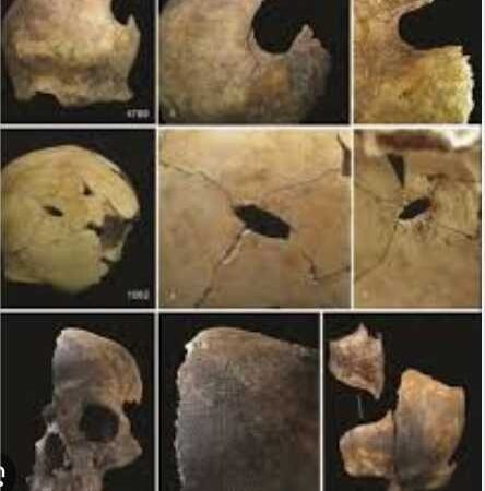 Ossos achados em massacre de 4 mil anos revelam sinais de canibalismo