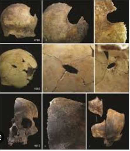 Ossos achados em massacre de 4 mil anos revelam sinais de canibalismo