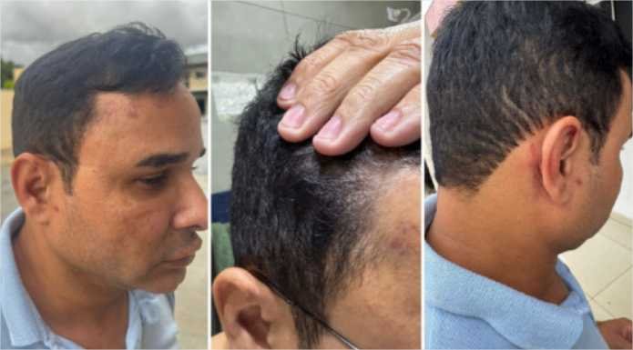 Sargento da PM nega ter dado soco em mulher e diz ter sido agredido durante festa