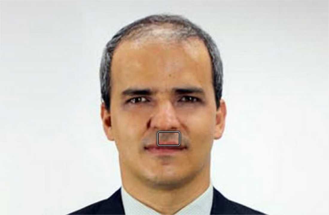 BRT: é hora de finalizar