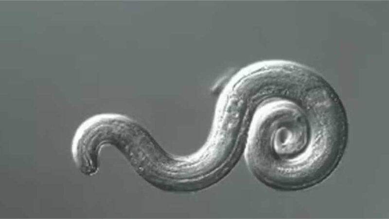 Mulher fica com perna “queimando” e descobre que parasita no cérebro é causa do problema