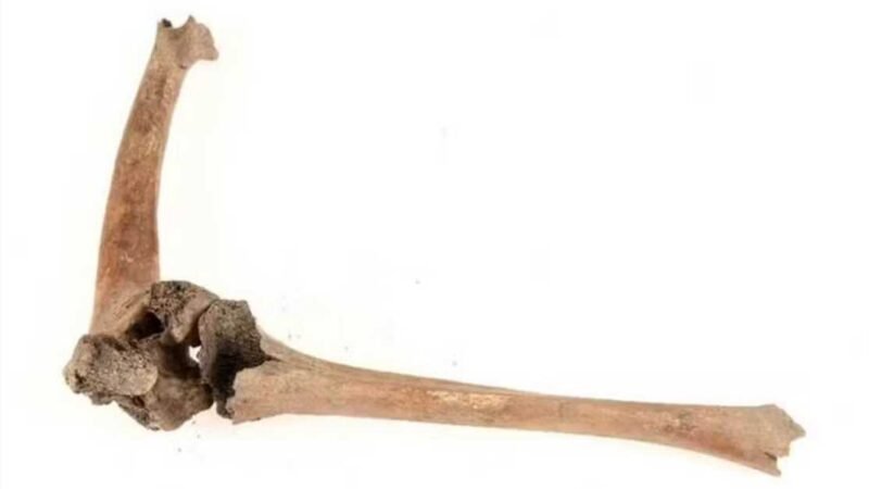 Como pessoas com deficiência viviam na Idade Média? Este esqueleto revelou