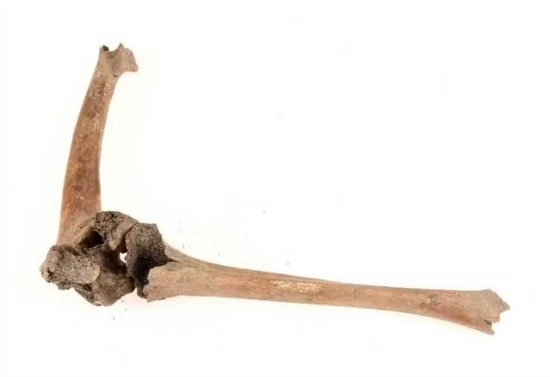 Como pessoas com deficiência viviam na Idade Média? Este esqueleto revelou