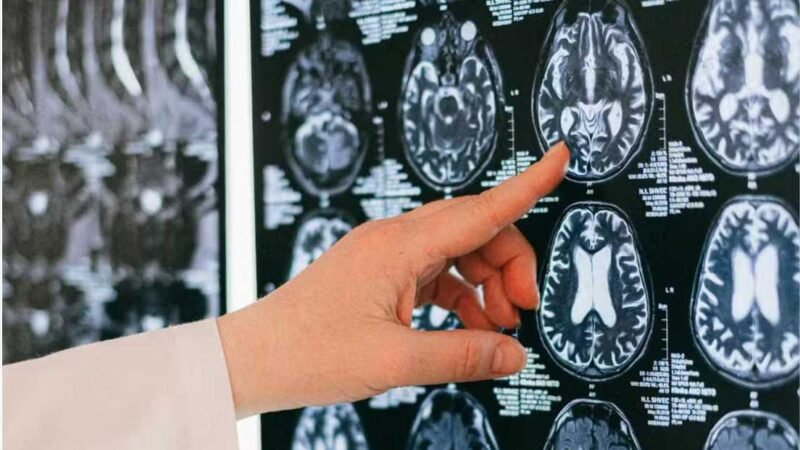 Novo estudo propõe melhor receita para manter o cérebro jovem; conheça