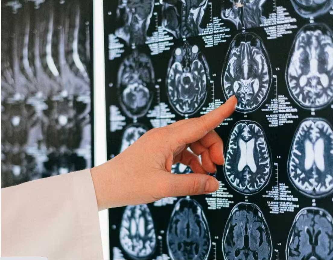 Novo estudo propõe melhor receita para manter o cérebro jovem; conheça