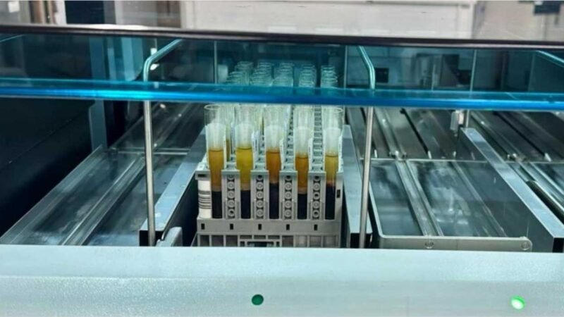 MT Hemocentro realiza 4,8 mil exames para captação de órgãos em 12 meses