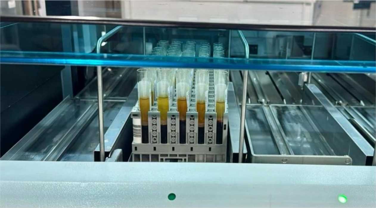 MT Hemocentro realiza 4,8 mil exames para captação de órgãos em 12 meses