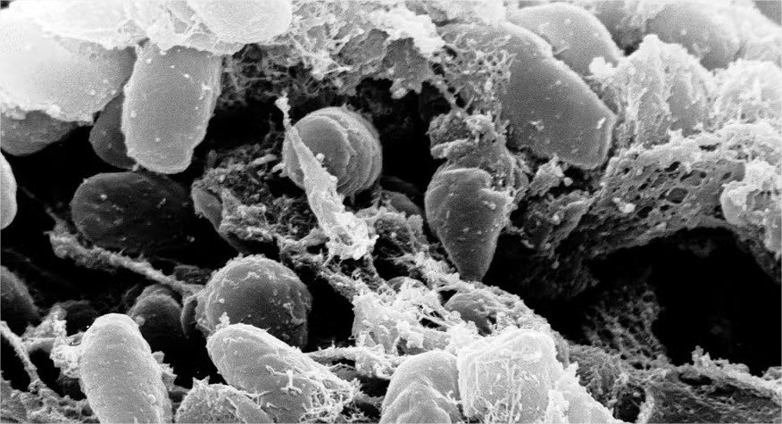 Peste negra: qual foi o último caso da doença no Brasil?