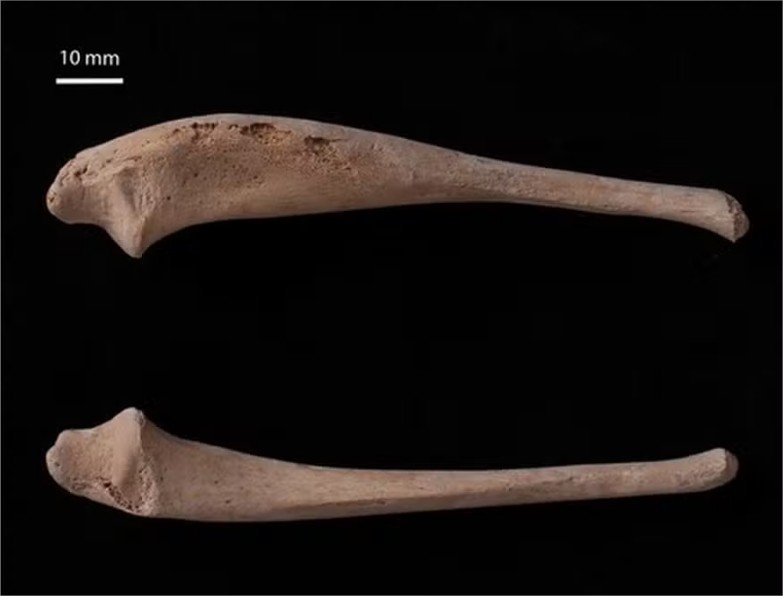 Doença rara é identificada em ossos de criança do século 12