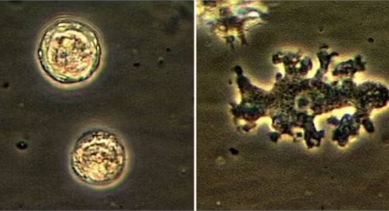 Amebas perigosas se espalham pelo mundo e mobilizam alerta urgente de cientistas