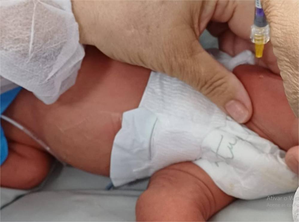 Hospitais estaduais oferecem proteção contra bronquiolite a bebês prematuros