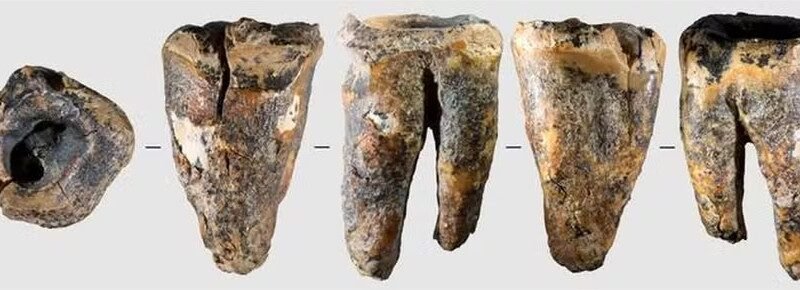 Dentistas neandertais usavam ferramentas de pedra para tratar cáries há 60 mil anos