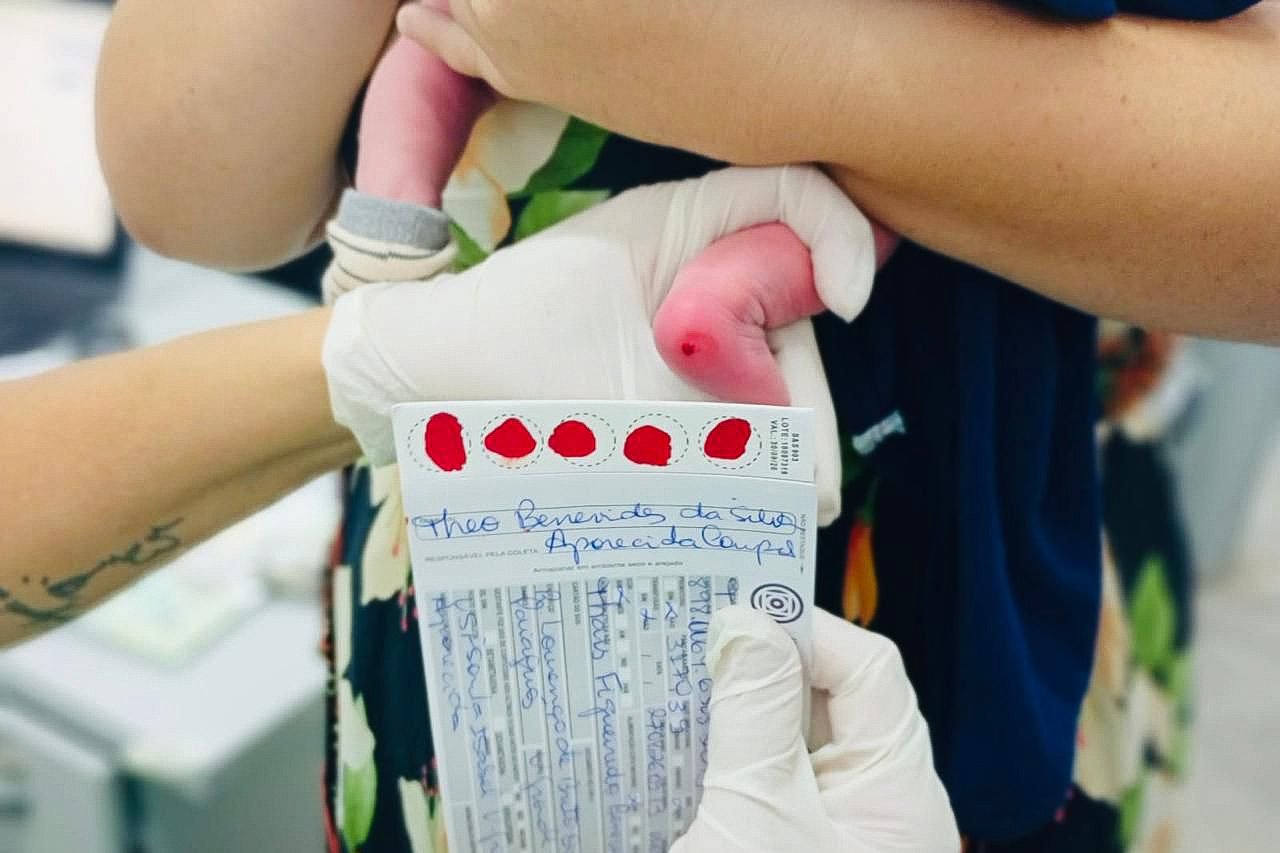 Teste do pezinho é realizado diariamente nas unidades de saúde de Várzea Grande