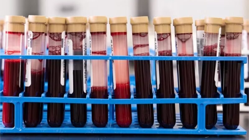 Chega ao Brasil novo exame de sangue que pode identificar 50 tipos de câncer