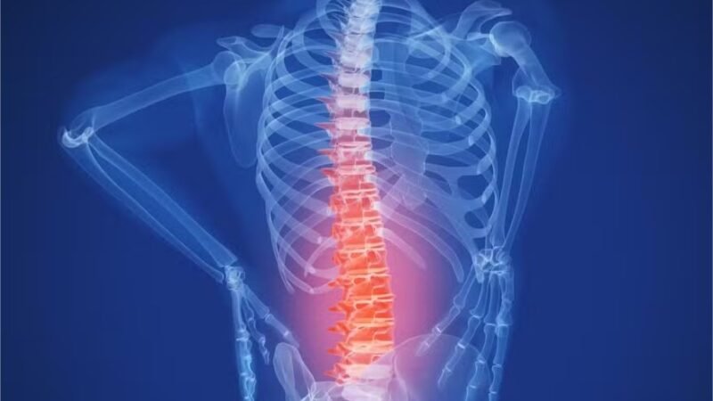 Médicos afirma ter feito primeiro transplante de medula espinhal na Rússia